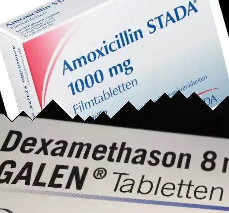 Amoxicilline vs Dexamethason