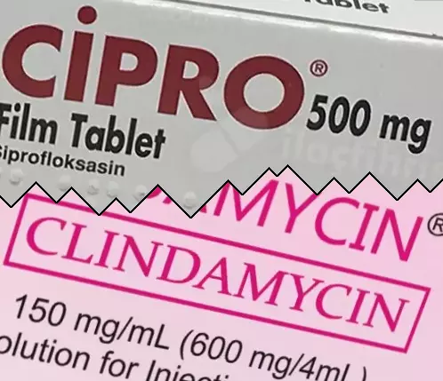 Cipro vs Clindamycine